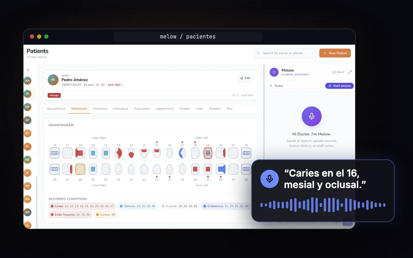 Melow — AI · SaaS
